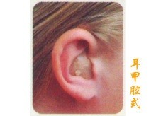 耳甲腔式助听器